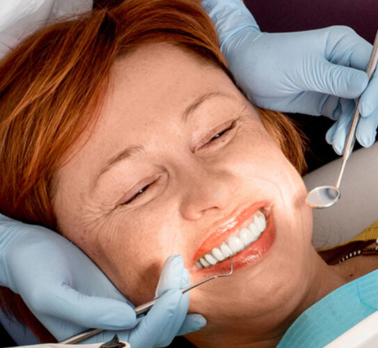 Composite Fillings