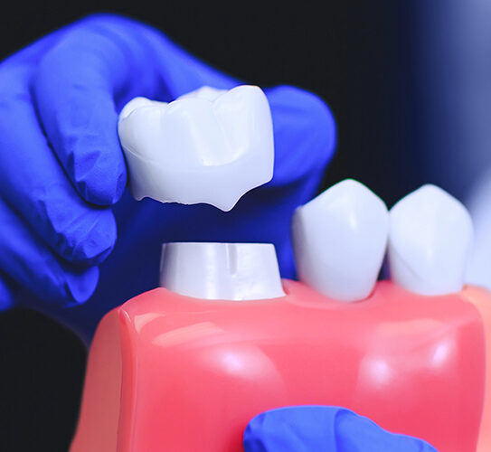 Crown lengthening