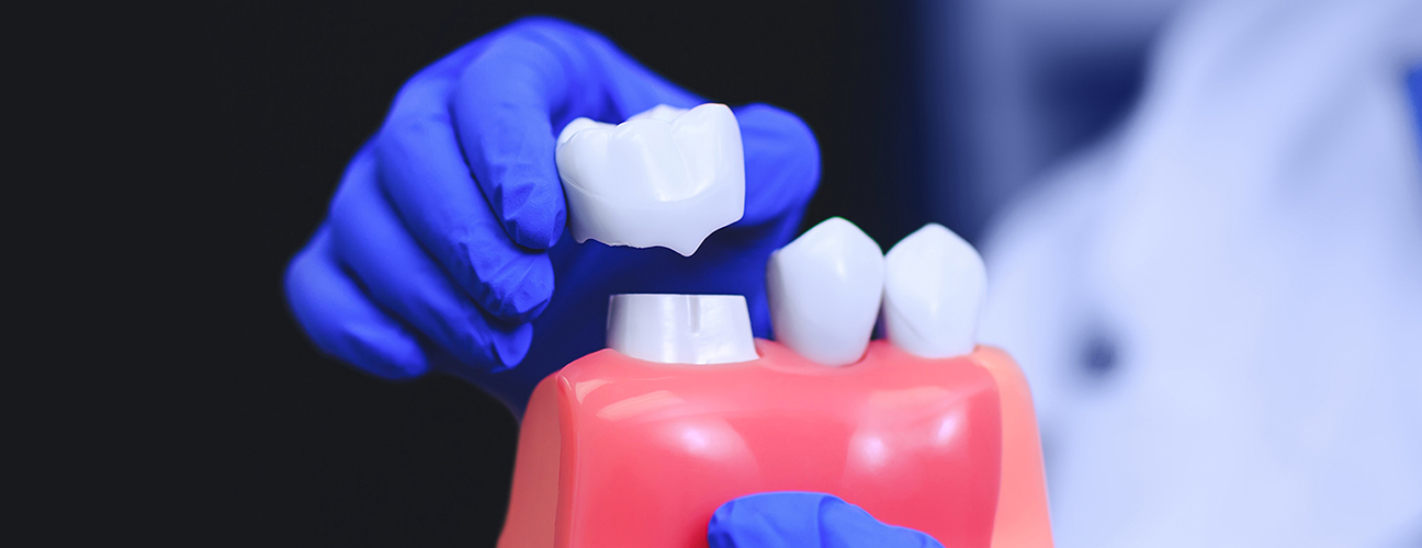 Crown lengthening